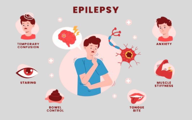 symptoms of Epilepsy